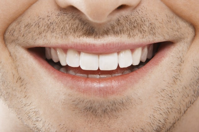 dentes brancos o masculino